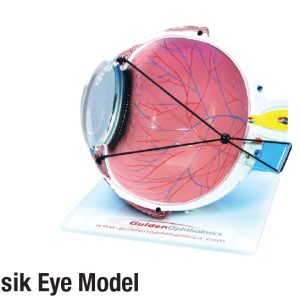 Lasik Eye Model