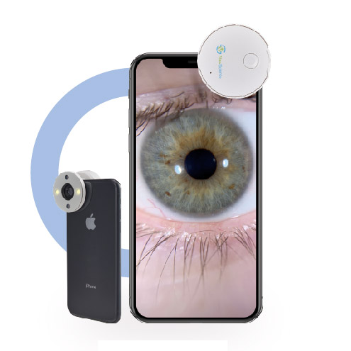 QuikVue VPA-100