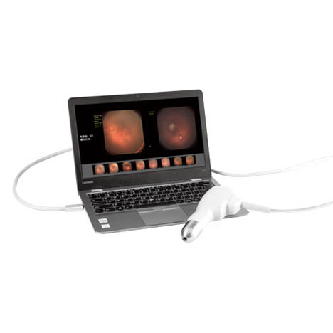 Euroscanner SW-8000P Portable Ophthalmic Wide Field Imaging System