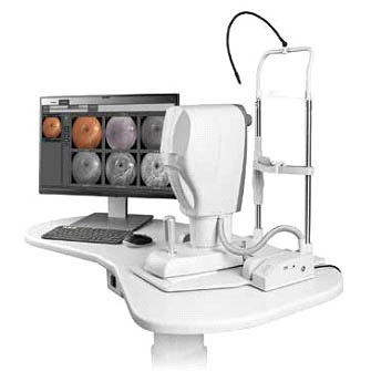 Euroscanner SW-8800 Fundus Mate
