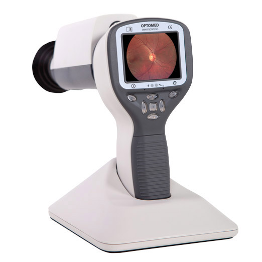 Optomed Smartscope FA