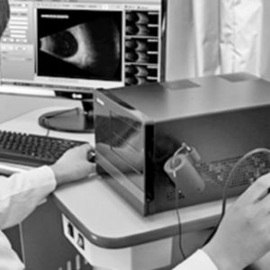 Euroscanner SW-2100 Ophthalmic A/B Scan
