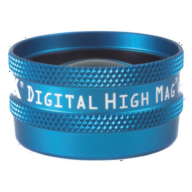 Digital High Mag